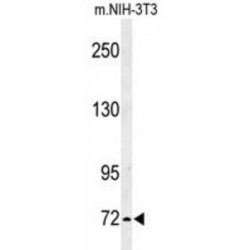 Interleukin 1 Receptor Accessory Protein Like Protein 2 (IL1RAPL2) Antibody