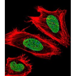Ubiquitin Like With PHD And Ring Finger Domains 1 (UHRF1) Antibody