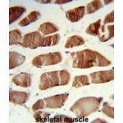 Cysteine-Rich Protein 2-Binding Protein (CSRP2BP) Antibody