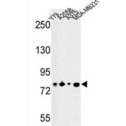 Cysteine-Rich Protein 2-Binding Protein (CSRP2BP) Antibody