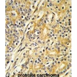 Lanosterol 14-Alpha Demethylase (CYP51A1) Antibody