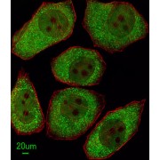 Polyunsaturated Fatty Acid Lipoxygenase ALOX12 (ALOX12) Antibody