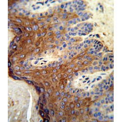 Polyunsaturated Fatty Acid Lipoxygenase ALOX12 (ALOX12) Antibody
