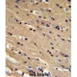 Tumor Protein P73 (TP73) Antibody