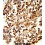 C1q And TNF Related 6 (C1QTNF6) Antibody