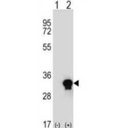 C1q And TNF Related 6 (C1QTNF6) Antibody