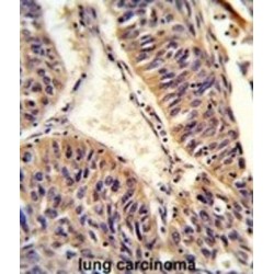 UDP-N-Acetylglucosamine Transferase Subunit ALG14 Homolog (ALG14) Antibody