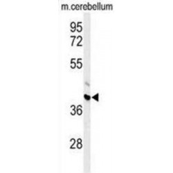 Abhydrolase Domain Containing 12 (ABHD12) Antibody