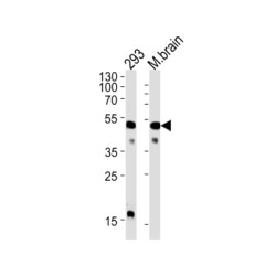 Glucagon Receptor (GCGR) Antibody