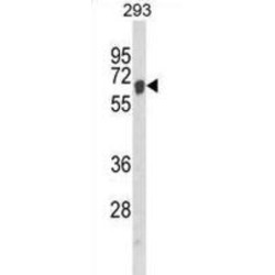 Apoptosis Inducing Factor 1, Mitochondrial (AIFM1) Antibody