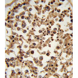 ETS Translocation Variant 6 (ETV6) Antibody