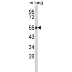 Glycocalicin (GC) Antibody