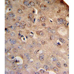 Sodium/Calcium Exchanger 1 (SLC8A1) Antibody