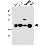WB analysis of various whole cell lysates, using HLA-G antibody.