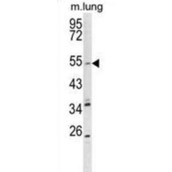 Potassium Voltage-Gated Channel Subfamily Q Member 1 (KCNQ1) Antibody