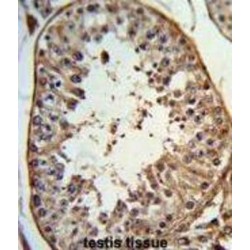 Protein Angel Homolog 1 (ANGEL1) Antibody