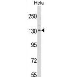 CAP-Gly Domain Containing Linker Protein 1 (CLIP1) Antibody