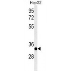 Alkaline Ceramidase 3 (ACER3) Antibody