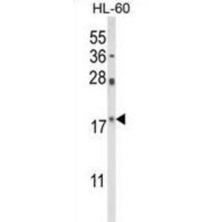 Peptidyl-Prolyl Cis-Trans Isomerase NIMA-Interacting 1 (PIN1) Antibody