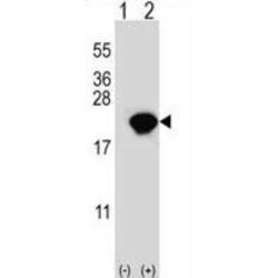 Peptidyl-Prolyl Cis-Trans Isomerase NIMA-Interacting 1 (PIN1) Antibody