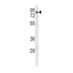 Low Density Lipoprotein Receptor (LDLR) Antibody