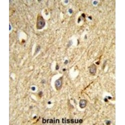 Ras-Related Protein Rab-8A (RAB8A) Antibody