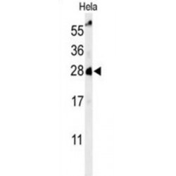Ras-Related Protein Rab-8A (RAB8A) Antibody