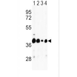 Aspartate Aminotransferase, Mitochondrial (GOT2) Antibody