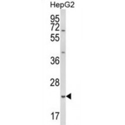 Glutathione S Transferase Alpha 4 (GSTA4) Antibody
