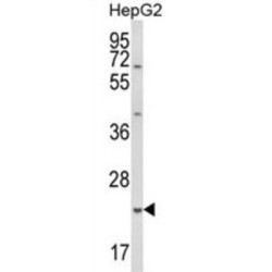 Glutathione S Transferase Alpha 4 (GSTA4) Antibody