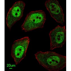 Apurinic/Apyrimidinic Endodeoxyribonuclease 2 (APEX2) Antibody