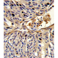 Apurinic/Apyrimidinic Endodeoxyribonuclease 2 (APEX2) Antibody