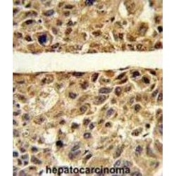 Arginase 1 (ARG1) Antibody