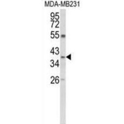 Arginase 1 (ARG1) Antibody