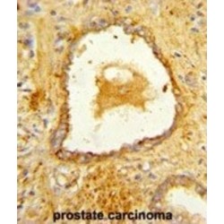Disabled Homolog 2 (DAB2) Antibody