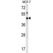 Inositol Polyphosphate Multikinase (IPMK) Antibody