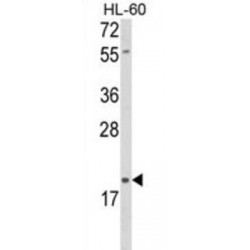 Protein Delta Homolog 2 (DLK2) Antibody