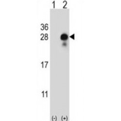 Protein Delta Homolog 2 (DLK2) Antibody