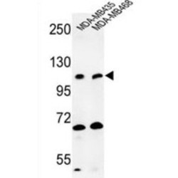 Exostoses (Multiple)-Like 3 (EXTL3) Antibody