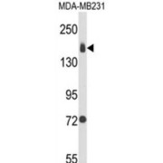 Integrin Alpha 2 (ITGA2) Antibody