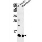 WB analysis of MDA-MB231 and MDA-MB435 cell line lysates, using SPRR1B Antibody.