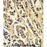 Vascular Endothelial Growth Factor Receptor 2 (VGFR2) Antibody