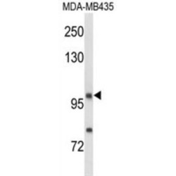 Neuropilin 1 (NRP1) Antibody