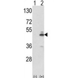 Pyruvate Kinase PKM (PKM) Antibody