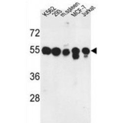 Protein Phosphatase 1H (PPM1H) Antibody