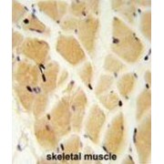 Glutamate Cysteine Ligase, Modifier Subunit (GCLM) Antibody