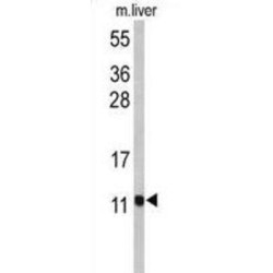 Pterin-4 Alpha-Carbinolamine Dehydratase 1 (PCBD1) Antibody