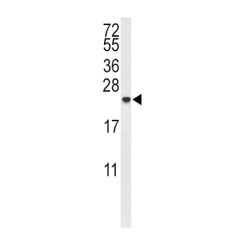 Interleukin 10 (IL10) Antibody