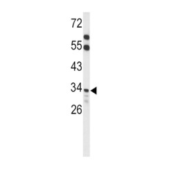 Acyl-Coenzyme A Thioesterase 8 (ACOT8) Antibody