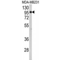 Bromo Adjacent Homology Domain-Containing 1 Protein (BAHD1) Antibody